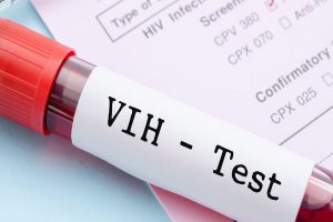Todo lo que se debe saber para prevenir o detectar el VIH/SIDA a tiempo