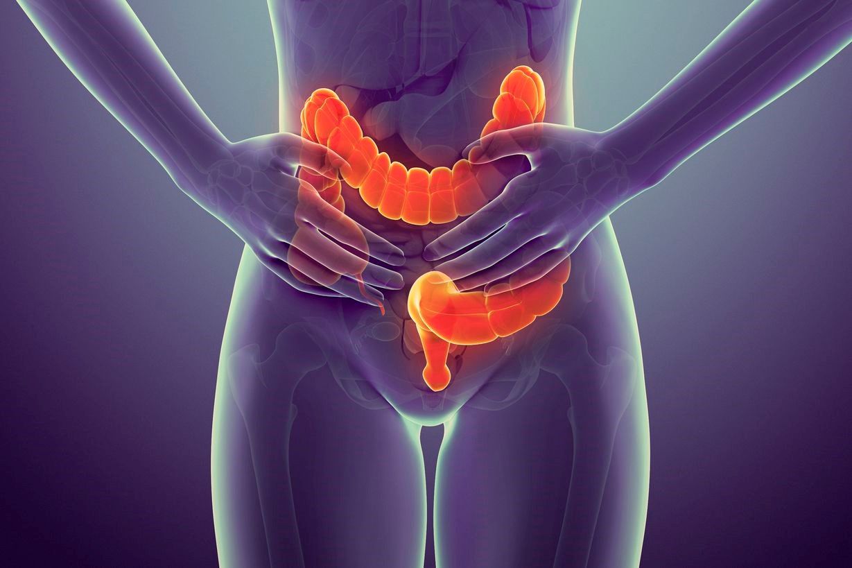¿Cómo manejar las enfermedades inflamatorias del intestino?